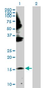 GEMIN6 Polyclonal Antibody, MaxPab™