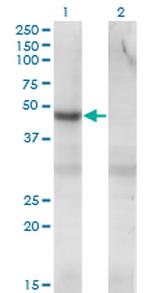 PIP4K2C Antibody in Western Blot (WB)