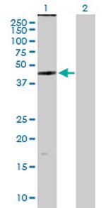 ZDHHC11 Polyclonal Antibody, MaxPab™