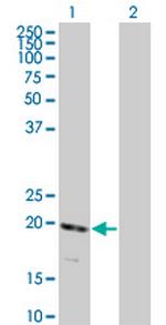 RNF122 Monoclonal Antibody (5E5)