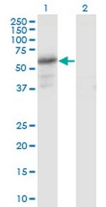PDZD3 Monoclonal Antibody (1F2)