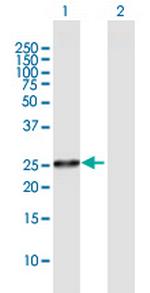 FLJ22662 Polyclonal Antibody, MaxPab™