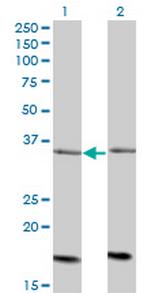 ADCK4 Antibody in Western Blot (WB)