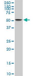 C10orf81 Monoclonal Antibody (3B6)