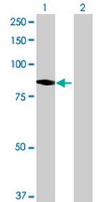 NOL10 Antibody in Western Blot (WB)
