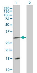 FLJ13236 Antibody in Western Blot (WB)