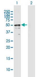 TRMT2B Polyclonal Antibody, MaxPab™