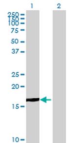 PHC3 Antibody in Western Blot (WB)