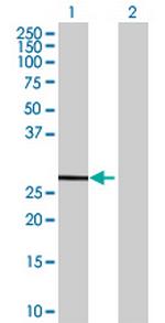FBXL18 Antibody in Western Blot (WB)