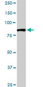 FBXL18 Antibody in Western Blot (WB)