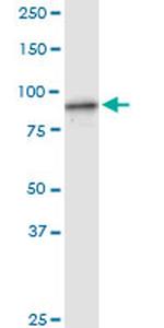 FBXL18 Antibody in Western Blot (WB)