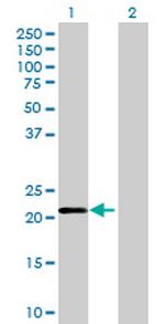ZNF614 Polyclonal Antibody, MaxPab™