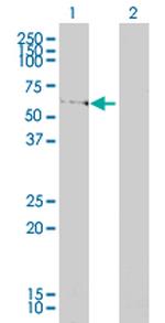 LSM16 Antibody in Western Blot (WB)