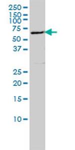 LSM16 Antibody in Western Blot (WB)