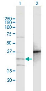 MOGAT2 Polyclonal Antibody, MaxPab™