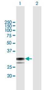 SPSB1 Polyclonal Antibody, MaxPab™