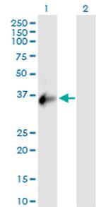 CXORF21 Antibody in Western Blot (WB)