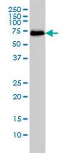 CDK5RAP3 Monoclonal Antibody (1G4)