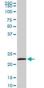 EFHD1 Monoclonal Antibody (1F5)