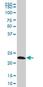 EFHD1 Antibody in Western Blot (WB)