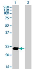 PPP1R2P9 Antibody in Western Blot (WB)