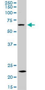 ZKSCAN3 Monoclonal Antibody (2A5)