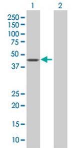 PUS1 Polyclonal Antibody, MaxPab™