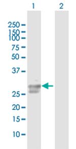 ULBP2 Polyclonal Antibody, MaxPab™