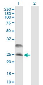 DNAJC5 Polyclonal Antibody, MaxPab™