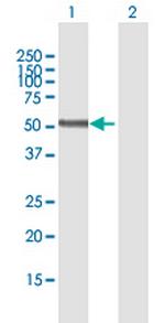 PNPLA3 Polyclonal Antibody, MaxPab™
