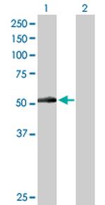 PNPLA3 Polyclonal Antibody, MaxPab™