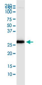 PDCD1LG2 Monoclonal Antibody (2E2)