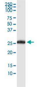 PDCD1LG2 Monoclonal Antibody (3C9)