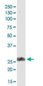 PDCD1LG2 Monoclonal Antibody (4G7)