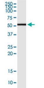 CD276 Monoclonal Antibody (1A6)
