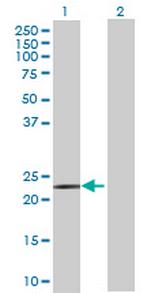ACAD10 Polyclonal Antibody, MaxPab™