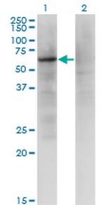 ZNF34 Monoclonal Antibody (1B11)