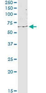 KIAA1706 Antibody in Western Blot (WB)
