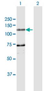 DDHD1 Polyclonal Antibody, MaxPab™