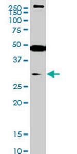 SET7 Monoclonal Antibody (5B4)