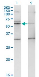 TMPRSS5 Monoclonal Antibody (2E5)