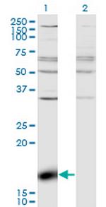 ZBP1 Monoclonal Antibody (2C10)