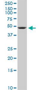 SLC2A10 Monoclonal Antibody (1E12)