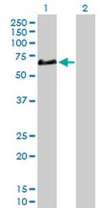 CFHR5 Polyclonal Antibody, MaxPab™