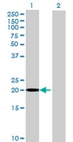 HCCA2 Polyclonal Antibody, MaxPab™