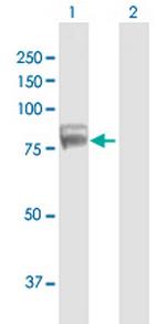 TDRD3 Polyclonal Antibody, MaxPab™