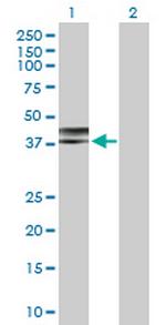 NDEL1 Polyclonal Antibody, MaxPab™