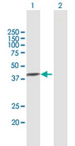 TXNDC5 Polyclonal Antibody, MaxPab™