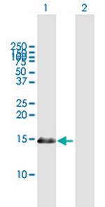 PDRG1 Antibody in Western Blot (WB)