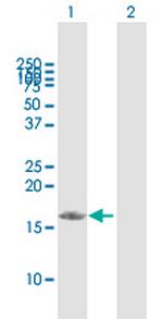 PDRG1 Antibody in Western Blot (WB)